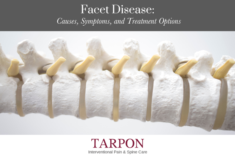 Facet Disease: Causes, Symptoms, and Treatment Options