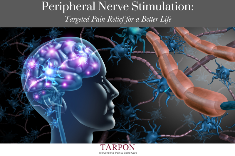 Peripheral Nerve Stimulation Targeted Pain Relief for a Better Life